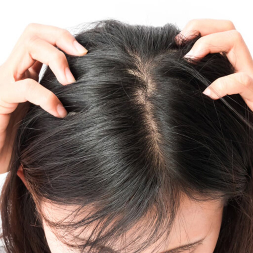 Hair Loss & Dandruff Treatment